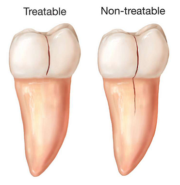 14-Fx-Treatablenot_-1
